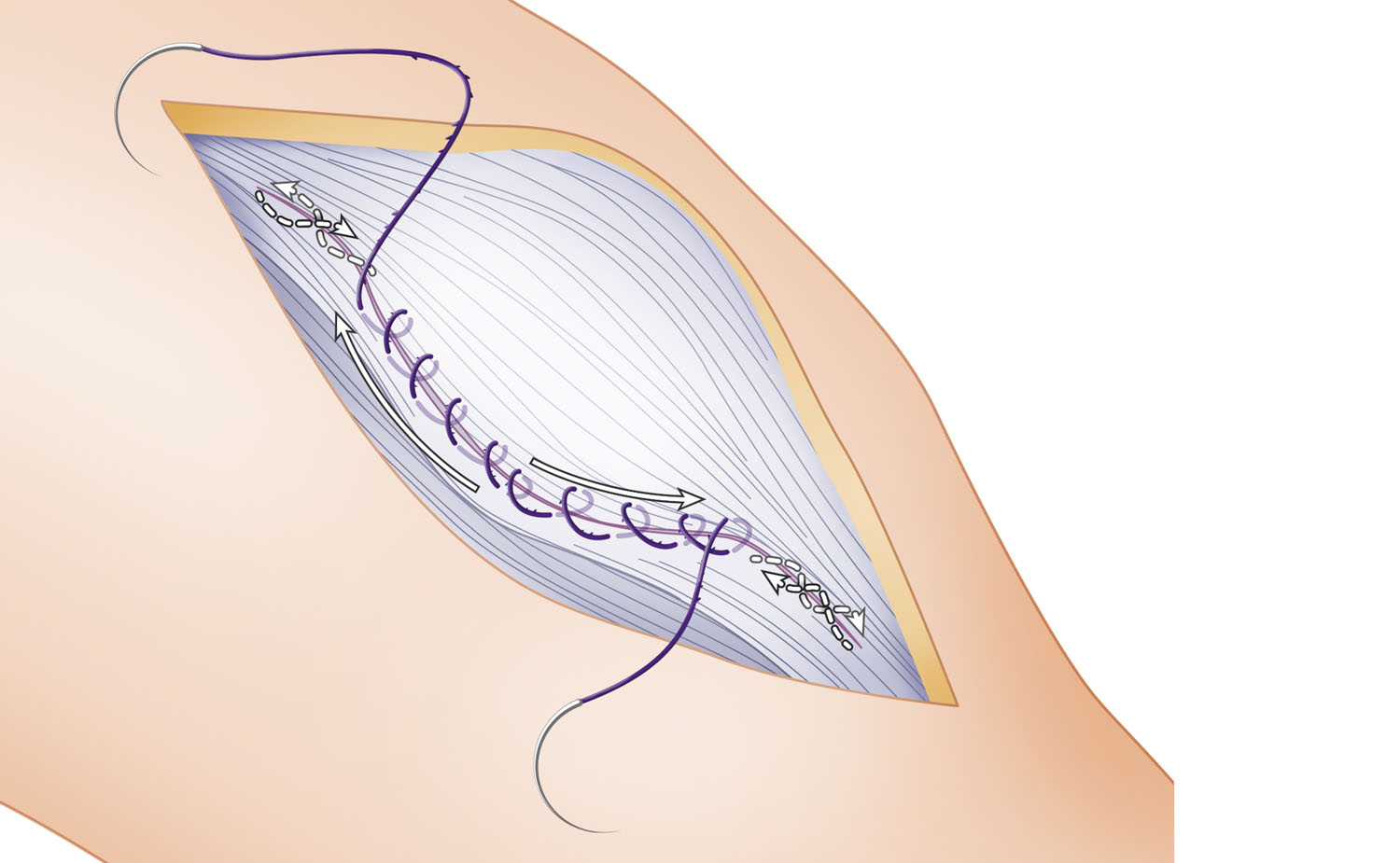 knee surgery